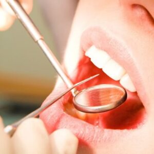 Curso Atendimento à Pacientes com Câncer Bucal