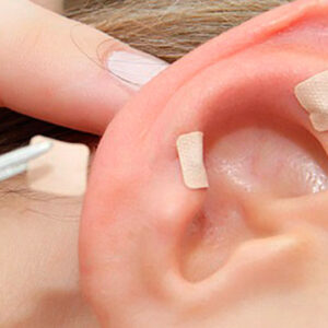 Curso Auriculoterapia