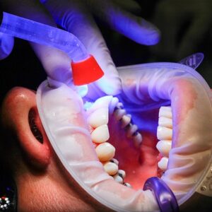 Assistência Odontológica em Pacientes Crônicos Renais